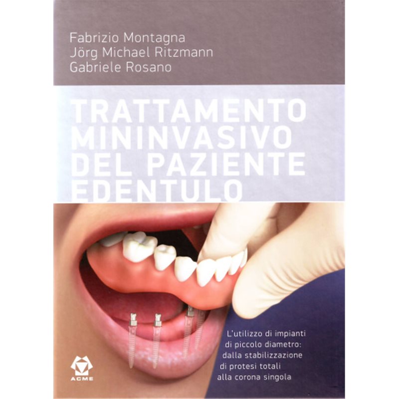 Trattamento mininvasivo del paziente edentulo + DVD